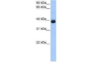 SERPINA5 antibody used at 1 ug/ml to detect target protein. (SERPINA5 抗体  (C-Term))
