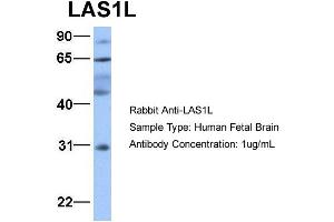 Host:  Rabbit  Target Name:  LAS1L  Sample Type:  Human Fetal Brain  Antibody Dilution:  1. (LAS1L 抗体  (Middle Region))
