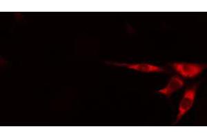 Immunofluorescence (fixed cells) (IF/ICC) image for anti-ATPase, H+ Transporting, Lysosomal 34kDa, V1 Subunit D (ATP6V1D) (Internal Region) antibody (ABIN6256920)