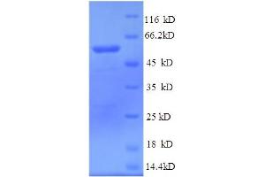 SDS-PAGE (SDS) image for Phospholipid Transfer Protein (PLTP) (AA 18-493) protein (His tag) (ABIN5713744)