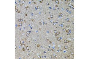 Immunohistochemistry of paraffin-embedded rat brain using GM13125 antibody. (Pramel15 抗体)
