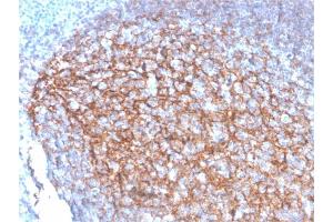 Formalin-fixed, paraffin-embedded human Tonsil stained with CD35 Mouse Monoclonal Antibody (SPM554). (CD35 抗体)