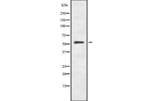 Western blot analysis of RPA49 using K562 whole cell lysates (POLR1E 抗体  (Internal Region))