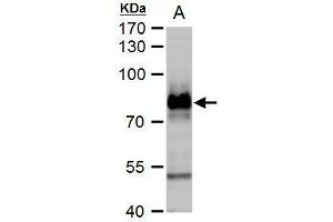 WB Image B-Raf antibody [N2C1], Internal detects B-Raf protein by western blot analysis.