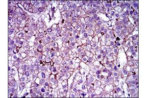 Flow Cytometry (FACS) image for anti-ATP-Binding Cassette, Sub-Family B (MDR/TAP), Member 5 (ABCB5) (AA 481-674) antibody (ABIN1842667)