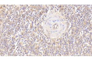 Detection of CD40L in Human Spleen Tissue using Polyclonal Antibody to Cluster Of Differentiation 40 Ligand (CD40L)