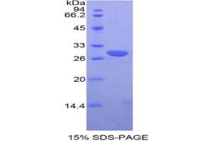 SDS-PAGE analysis of Mouse Pim-2 Oncogene Protein.