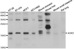 Western blot analysis of extracts of various cell lines, using AGR2 antibody. (AGR2 抗体)