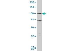 PROX1 monoclonal antibody (M09), clone 1H6 Western Blot analysis of PROX1 expression in MCF-7 . (PROX1 抗体  (AA 638-737))
