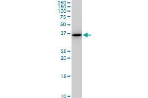 SNAI2 monoclonal antibody (M05), clone 3C12. (SLUG 抗体  (AA 97-169))