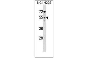 Western blot analysis of D172g / SIRPG in NCI-H292 cell line lysates (35ug/lane). (SIRPG 抗体  (Middle Region))