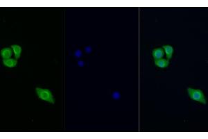 Detection of PIK3Cb in Human Hela cell using Polyclonal Antibody to Phosphoinositide-3-Kinase Catalytic Beta Polypeptide (PIK3Cb) (PIK3CB 抗体  (AA 807-1070))