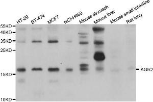 Western blot analysis of extracts of various cell lines, using AGR2 antibody (ABIN5975470) at 1/1000 dilution. (AGR2 抗体)