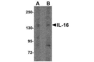 Image no. 1 for anti-Interleukin 16 (IL16) (N-Term) antibody (ABIN341724) (IL16 抗体  (N-Term))