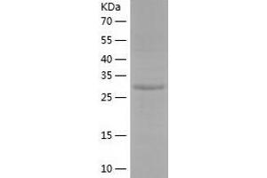 Western Blotting (WB) image for NECAP Endocytosis Associated 2 (NECAP2) (AA 1-263) protein (His tag) (ABIN7124122)