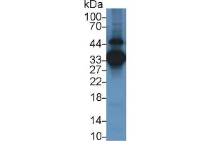 Detection of ANXA3 in Human Lung lysate using Monoclonal Antibody to Annexin A3 (ANXA3) (Annexin A3 抗体  (AA 190-312))