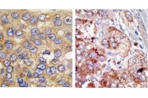 Image no. 3 for anti-6-phosphofructo-2-Kinase/fructose-2,6-Biphosphatase 4 (PFKFB4) (AA 274-303) antibody (ABIN360670) (PFKFB4 抗体  (AA 274-303))