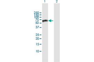 Western Blot analysis of GBA expression in transfected 293T cell line by GBA MaxPab polyclonal antibody. (GBA 抗体  (AA 1-536))