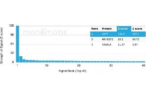 Protein Array (PAr) image for anti-Keratin 7 (KRT7) antibody (ABIN6939869)