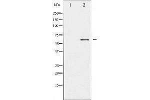 Western Blotting (WB) image for anti-Proto-oncogene tyrosine-protein kinase Src (Src) (pTyr419) antibody (ABIN6255912)