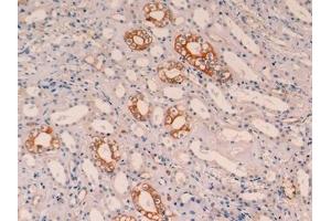Immunohistochemistry (IHC) image for anti-Keratin 19 (KRT19) (AA 127-322) antibody (ABIN7426235)