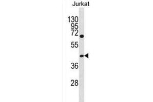 GCNT6 Antibody (C-term) (ABIN1536996 and ABIN2850077) western blot analysis in Jurkat cell line lysates (35 μg/lane). (GCNT6 抗体  (C-Term))