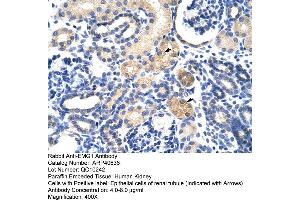 Rabbit Anti-EMG1 Antibody  Paraffin Embedded Tissue: Human Kidney Cellular Data: Epithelial cells of renal tubule Antibody Concentration: 4. (EMG1 抗体  (N-Term))