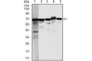 Western blot analysis using MSN mouse mAb against HeLa (1), A431 (2),Jurkat(3), HEK293(4), and COS7 (5) cell lysate. (Moesin 抗体)