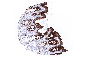 colon descendens mucosa (Recombinant KRT20 抗体  (AA 196-323))