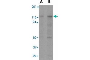 Western blot analysis of APAF1 in K-562 cell lysate with APAF1 monoclonal antibody, clone 2E10  at (A) 0.