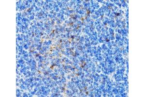 Immunohistochemistry of paraffin-embedded Mouse spleen using PSMD10 Polyclonal Antibody at dilution of 1:100 (40x lens). (PSMD10 抗体)