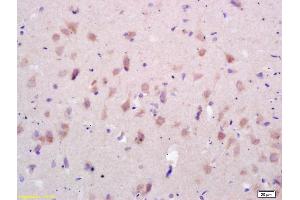 Formalin-fixed and paraffin embedded rat brain labeled with Rabbit Anti GluR1/AMPA Polyclonal Antibody, Unconjugated (ABIN1385842) at 1:200 followed by conjugation to the secondary antibody and DAB staining (GluR1, GluR2 抗体  (AA 141-240))