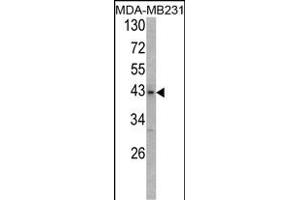 Western blot analysis of USP12/USP46 Antibody (C-term) (ABIN388899 and ABIN2839185) in MDA-M cell line lysates (35 μg/lane). (USP12,USP46 (AA 315-345), (C-Term) 抗体)