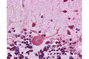 Immunohistochemistry (IHC) image for anti-Heat Shock Protein 90kDa alpha (Cytosolic), Class B Member 1 (HSP90AB1) (N-Term) antibody (ABIN574430)