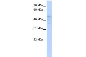 DLL3 antibody used at 1 ug/ml to detect target protein. (DLL3 抗体)