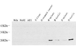 Western Blot analysis of various samples using p19 INK4d Polyclonal Antibody at dilution of 1:500. (CDKN2D 抗体)