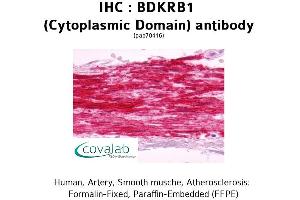 Image no. 2 for anti-Bradykinin Receptor B1 (BDKRB1) (1st Cytoplasmic Domain) antibody (ABIN1732268) (BDKRB1 抗体  (1st Cytoplasmic Domain))