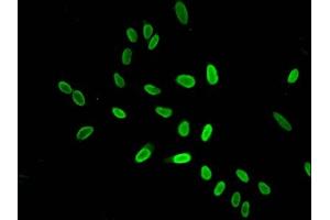 Immunofluorescence (IF) image for anti-Histone Cluster 1, H4a (HIST1H4A) (acLys16) antibody (ABIN7139167)