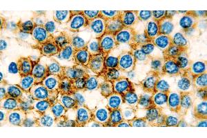 Immunohistochemistry (IHC) image for anti-Integrin, alpha X (Complement Component 3 Receptor 4 Subunit) (ITGAX) (N-Term) antibody (ABIN7538851)