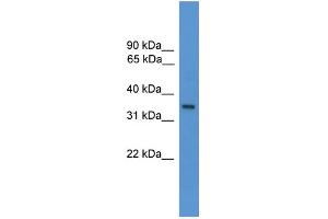 WB Suggested Anti-OR1J1 Antibody Titration: 1. (OR1J1 抗体  (C-Term))