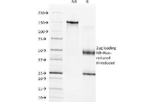 SDS-PAGE Analysis of Purified TIMP1 Mouse Monoclonal Antibody (2A5). (TIMP1 抗体  (AA 72-82))