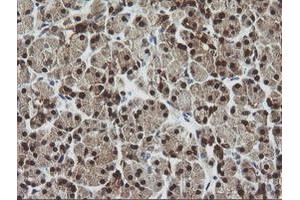 Image no. 1 for anti-Cytidine Monophosphate (UMP-CMP) Kinase 1, Cytosolic (CMPK1) antibody (ABIN1497544) (Cytidine Monophosphate (UMP-CMP) Kinase 1, Cytosolic (CMPK1) 抗体)