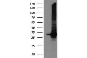 Western Blotting (WB) image for anti-Glutathione S-Transferase theta 2 (GSTT2) antibody (ABIN1498553) (GSTT2 抗体)