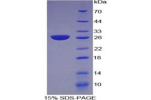 SDS-PAGE of Protein Standard from the Kit (Highly purified E. (NNMT ELISA 试剂盒)