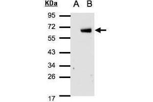 WB Image Western Blot analysis of IRF6 expression in transfected 293T cell line by IRF6 polyclonal antibody. (IRF6 抗体  (C-Term))