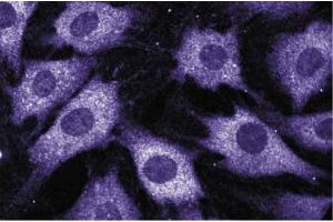 Immunofluorescence staining of C3H/10T1/2 cells (Mouse embryonic fibroblasts, ATCC CCL-226). (NCF2 抗体  (AA 317-469))