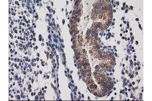 Image no. 3 for anti-Destrin (Actin Depolymerizing Factor) (DSTN) antibody (ABIN1497908) (Destrin 抗体)