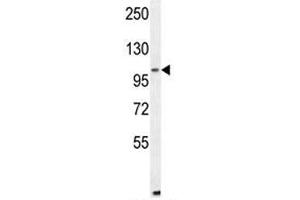 ALDH1L2 antibody western blot analysis in mouse NIH3T3 lysate (ALDH1L2 抗体  (AA 743-772))