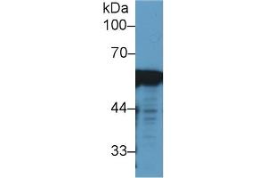 Western Blotting (WB) image for anti-Vimentin (VIM) antibody (ABIN7426163)