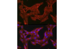Immunofluorescence analysis of C6 cells using TFEB antibody (ABIN6128819, ABIN6149043, ABIN6149045 and ABIN6223149) at dilution of 1:100. (TFEB 抗体)